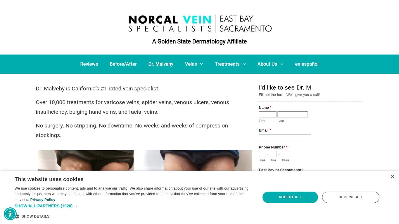 Screenshot of https://www.norcalvein.com/ Screenshot of https://www.norcalvein.com/